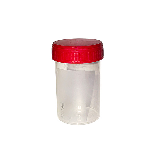 Urinbecher mit Deckel, steril - 60 ml, 1x