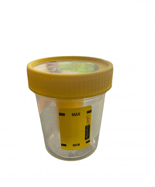 Urinbecher mit Deckel, steril, Vakuumnadel - 120 ml, 1x